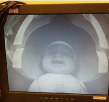 MRI Training