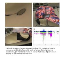 smartbrace